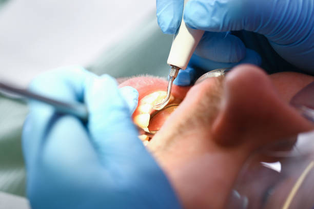 Best Emergency Treatment for Oral Infections in Prescott, WI