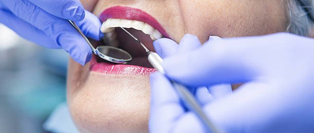 Best Knocked-Out Tooth (Avulsed Tooth) Treatment in Prescott, WI
